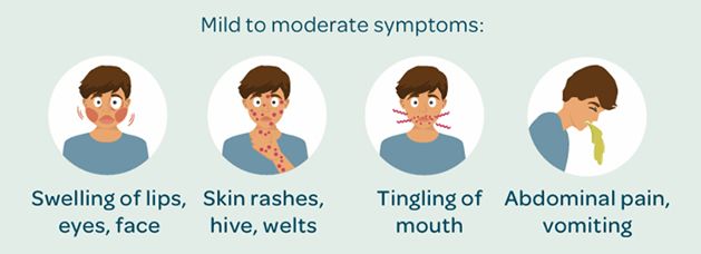 MILD to MODERATE allergic reaction